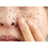 【アウトレット】バブルピーリングKURO 80g 2個 アイケイ　角質ケア　フェイスケア