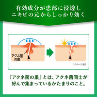 メンソレータム アクネス25メディカルミストb 100ml ロート製薬 にきび【第2類医薬品】
