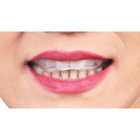 東京企画販売 歯ぎしりマウスガードフィット 682826 1個（直送品）