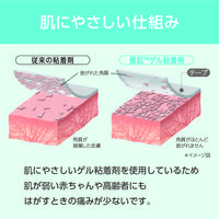 ニトムズ 優肌パーミロール Lite L34R10 5巻　フィルムドレッシング（防水フィルムロール）