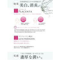 ROZEBE（ロゼべ） プラセンタエンリッチローション（しっとりタイプ） 美白化粧水 ＜医薬部外品＞ 150mL WHD