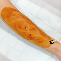 アグリス PASスティックα(薬液1.5mL) 794180025 1箱(36本入)【第3類医薬品】