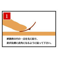 日本薬興 東洋医学療法の鍼治療 皮内針「ひ鍼」 30針 Q00510 1セット(30針入)（直送品）