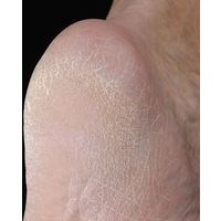 セーブ・インダストリー TSUBAKI ダイヤモンドかかとエステ SV-3062（直送品）