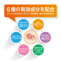 オイラックスDX軟膏 16g 第一三共ヘルスケア　塗り薬 ステロイド配合 湿疹・かぶれ・皮膚炎・かゆみ【指定第2類医薬品】