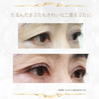 ルドゥーブル プレミアム 2mL アーチブ