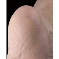 セーブ・インダストリー TSUBAKI ダイヤモンドかかとエステ SV-3062（直送品）