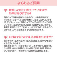 ニチバン アトファイン 傷あとケアテープ Lサイズ 50mm×164mm ATFL 1箱（6枚入り）
