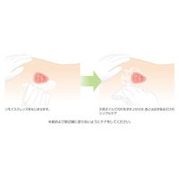 アルケア リモイスクレンズ(レギュラー) 17701 1本