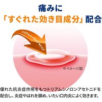 アフタガード 5g 佐藤製薬 軟膏タイプ 口内炎治療薬【指定第2類医薬品】