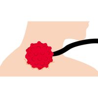 富士パックス販売 凸凹したボールと硬いアームで肩たたき 凸凹ドンドン FP-349 1セット(3個入)（直送品）