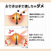 オデキュアEX 12g 池田模範堂 化膿性皮膚疾患 とびひ おでき【第2類医薬品】
