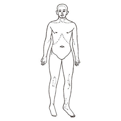 イマムラ 人体図型ゴム印 06421 1箱（3個入） 24-3050-03（直送品）