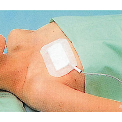 大型滅菌プラスター 80×130mm No.80 1セット（60枚：30枚入×2箱